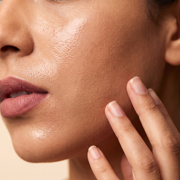 Oily Skin