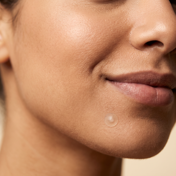 Acne-Prone Skin
