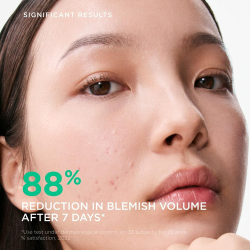 Bioderma Sébium Serum Anti Imperfection 30 ml