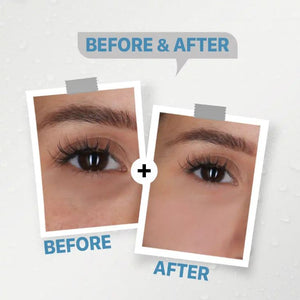 See-Lit Intense De- Puffing Serum 30 Ml2