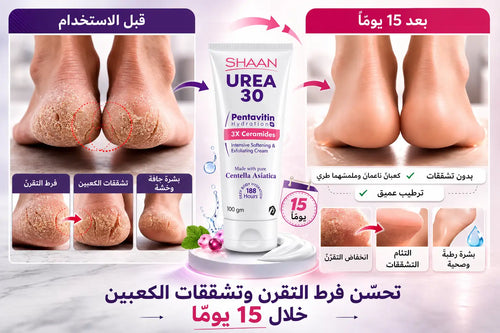 Shaan Urea 30% Body Cream 100gm