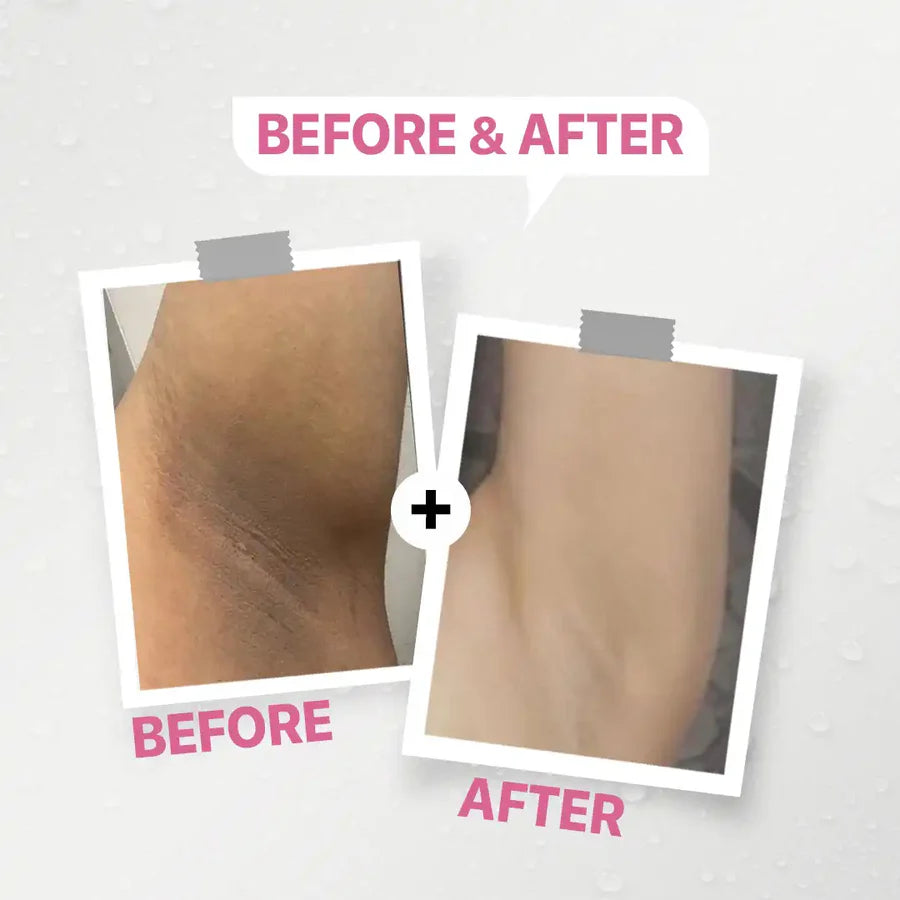 كريم داكي لتفتيح البشرة الحساسة 50 غرام