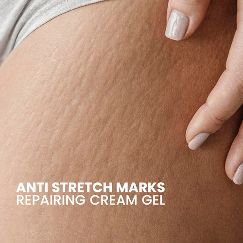 Methytral Anti Stretch Marks Repairing Gel 50gm