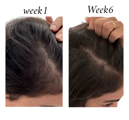 Raw African Follicle Booster Spray 125ml