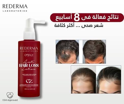 Rederma Anti Hair Loss Spray