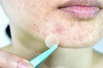 CURE AID HYDROCOLLOID SPOT24"S