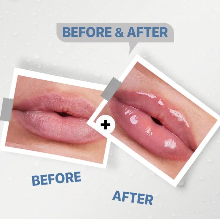 See-Lit Lip Balm 15Gm4