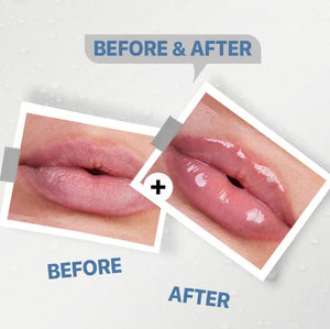 See-Lit Lip Balm 15Gm4