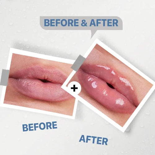 See-Lit Lip Balm 15Gm4