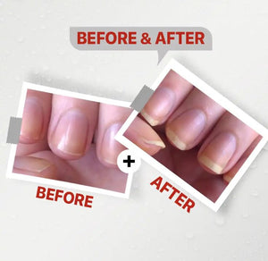 See-Lit Nail Serum 10 Ml4