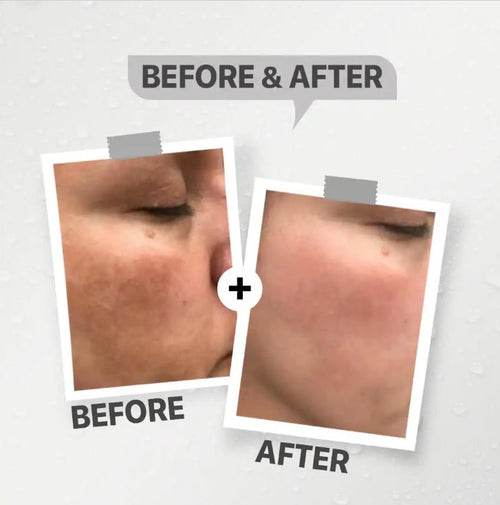 See-Lit Anti-Brown Spot Fluid 60Ml3